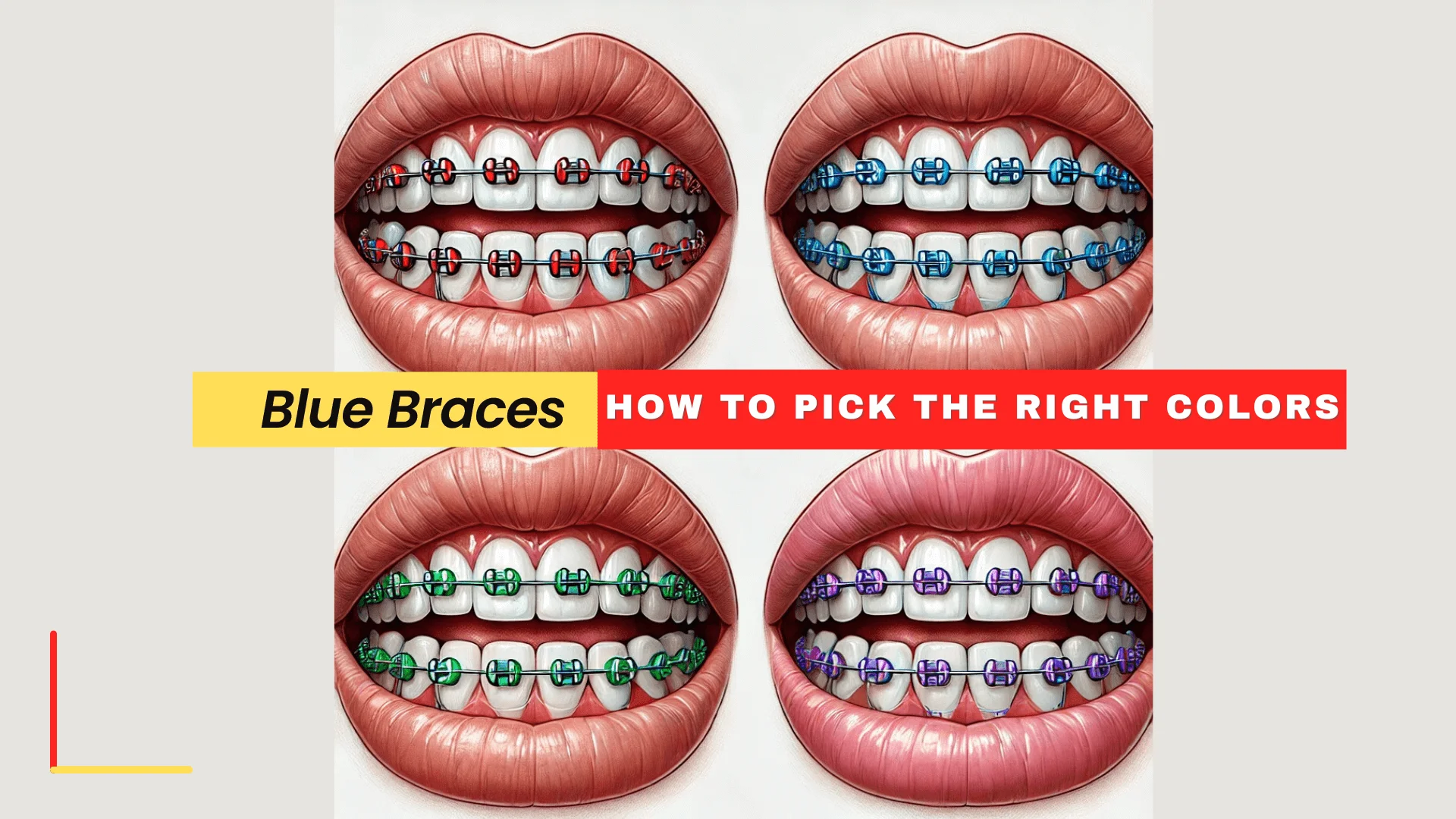 Blue Braces How to Pick the Right Colors for Your Braces