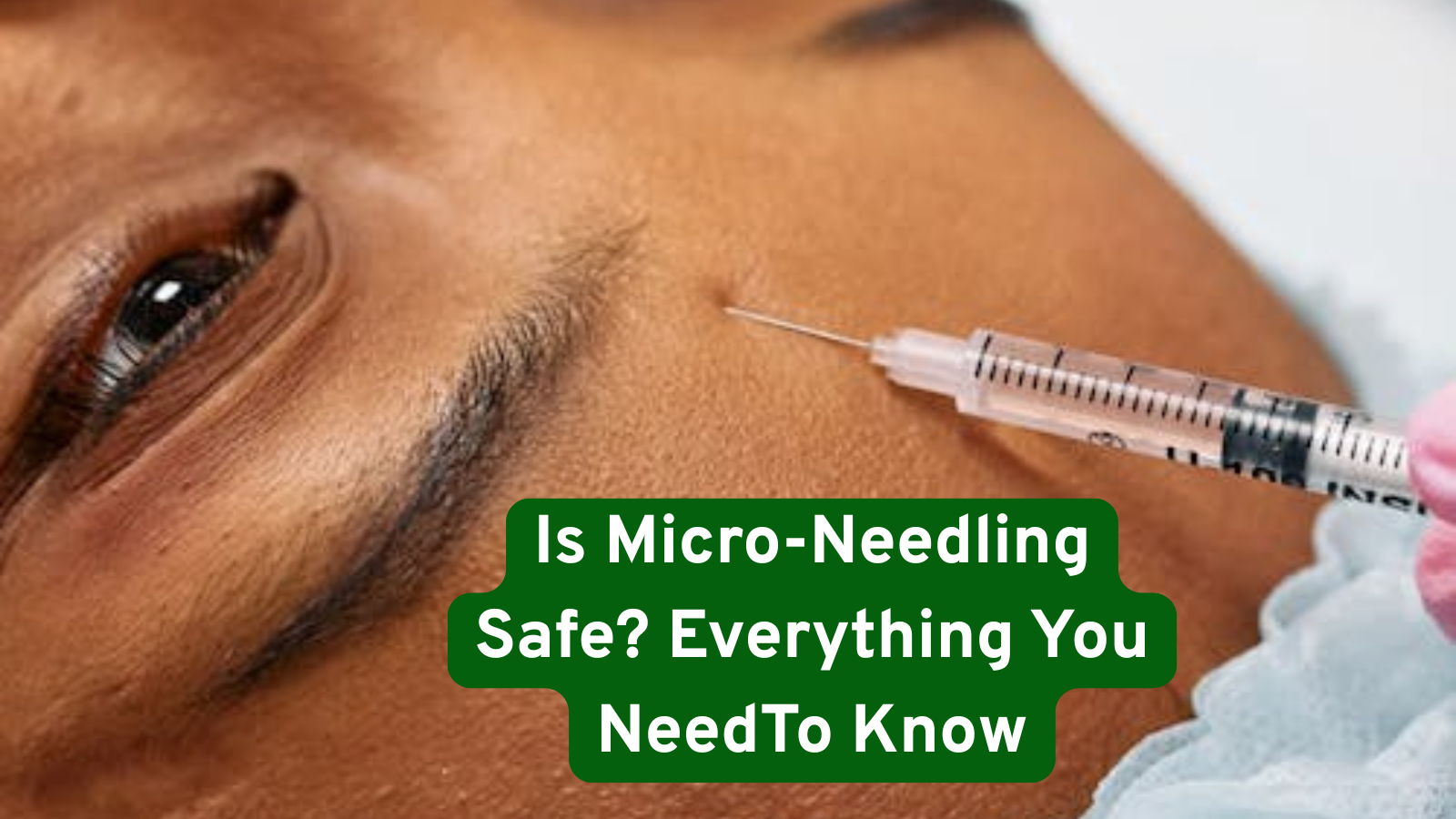 Is Micro-Needling Safe Everything You NeedTo Know