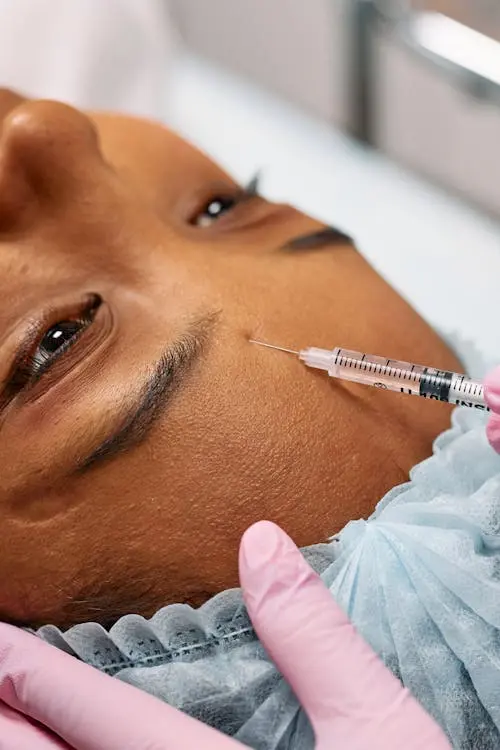 Skin Needling